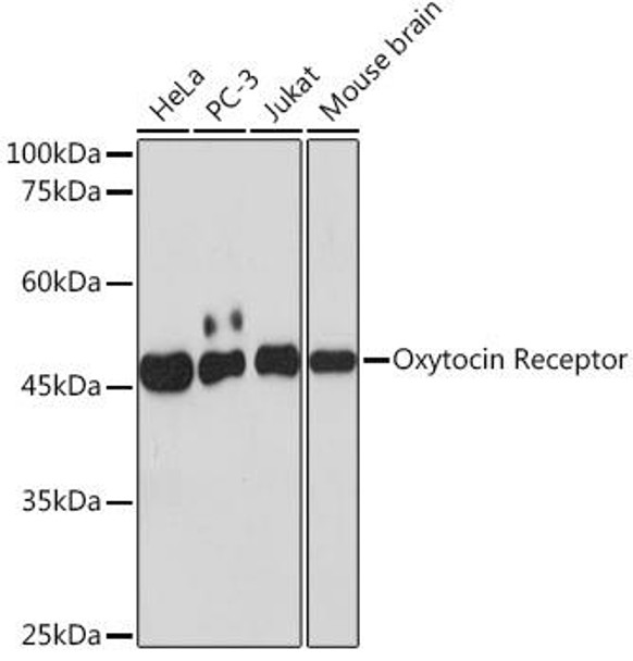 Oxytocin Receptor Rabbit Monoclonal Antibody (CAB19740)