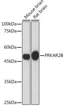 PRKAR2B Rabbit Monoclonal Antibody (CAB19745)