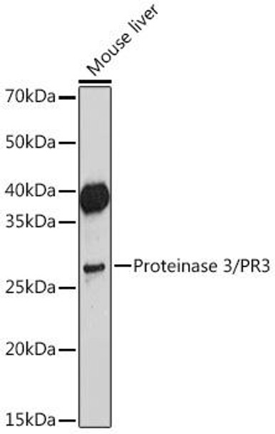 PR3 Rabbit Monoclonal Antibody (CAB19748)