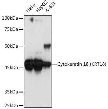 Cytokeratin 18 (KRT18) Rabbit Monoclonal Antibody (CAB19778)