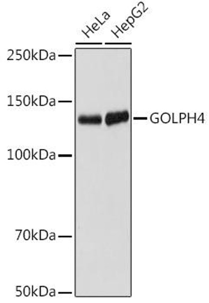 GOLPH4 Rabbit Monoclonal Antibody (CAB19790)
