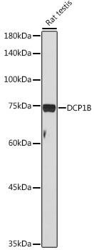 DCP1B Rabbit Polyclonal Antibody (CAB20150)