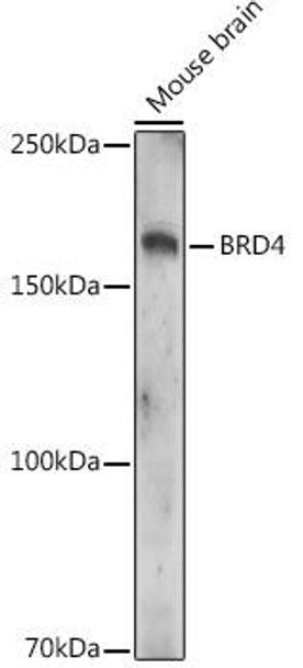 Acetyl-BRD4-K332 Rabbit Polyclonal Antibody (CAB20208)