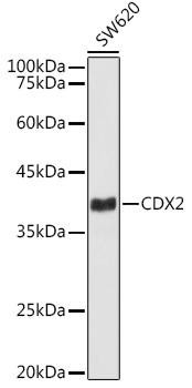 CDX2 Rabbit Monoclonal Antibody (CAB20222)