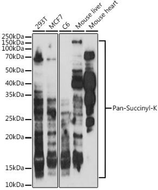 Pan-Succinyl-K Rabbit Polyclonal Antibody (CAB20503)