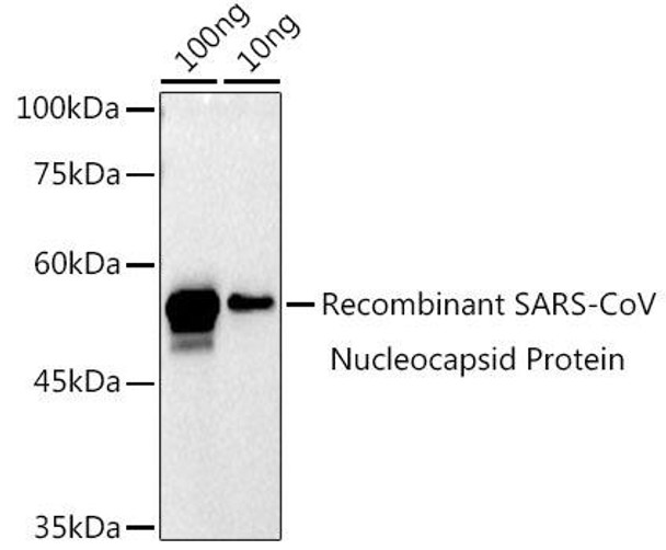 SARS-CoV-2 N Protein Rabbit Polyclonal Antibody (CAB20607)