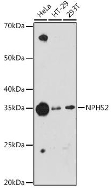 NPHS2 Rabbit Monoclonal Antibody (CAB2302)