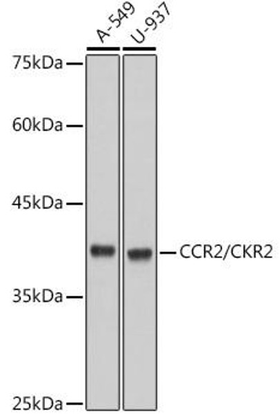 CCR2/CKR2 Rabbit Monoclonal Antibody (CAB2385)
