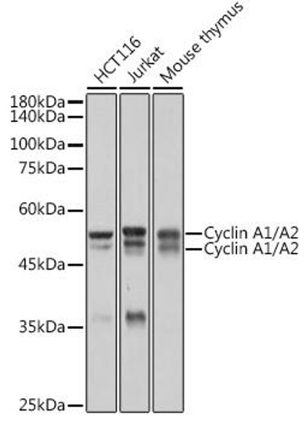 Cyclin A1/A2 Rabbit Monoclonal Antibody (CAB2635)