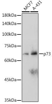 p73 Rabbit Monoclonal Antibody (CAB2670)