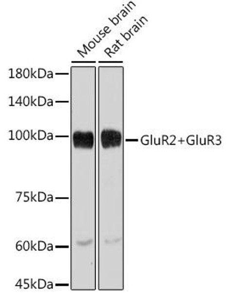 GluR2+GluR3 Rabbit Monoclonal Antibody (CAB2754)