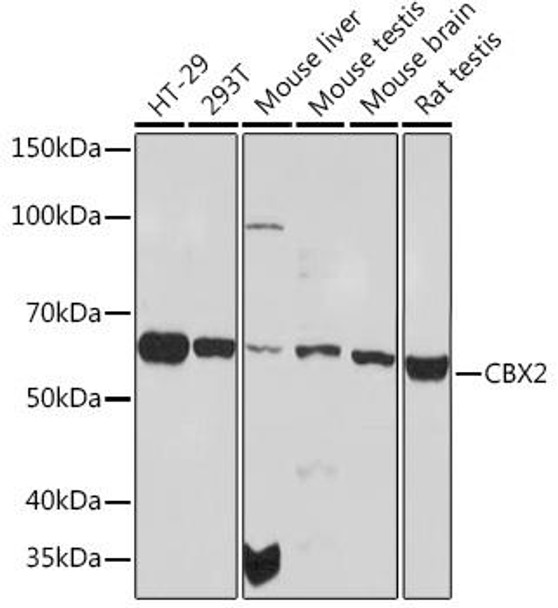 CBX2 Rabbit Monoclonal Antibody (CAB3294)