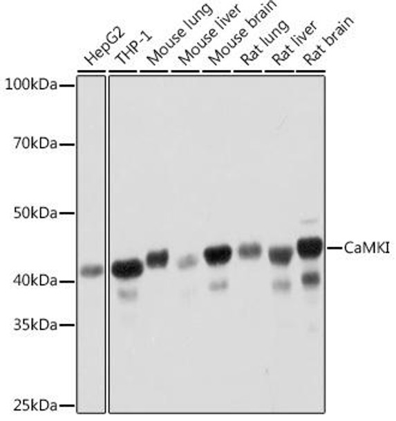 CaMKI Rabbit Monoclonal Antibody (CAB3529)