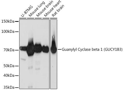 Guanylyl Cyclase beta 1 (GUCY1B3) Rabbit Monoclonal Antibody (CAB3687)