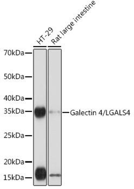 Galectin 4/LGALS4 Rabbit Monoclonal Antibody (CAB3691)