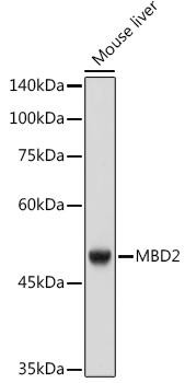 MBD2 Rabbit Monoclonal Antibody (CAB4032)
