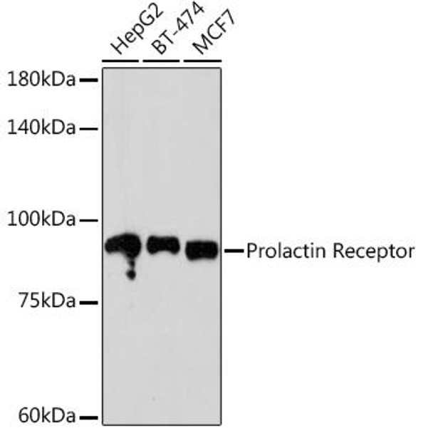 Prolactin Receptor Rabbit Monoclonal Antibody (CAB4121)