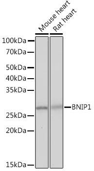 BNIP1 Rabbit Monoclonal Antibody (CAB4405)