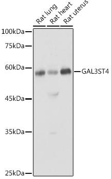 GAL3ST4 Rabbit Polyclonal Antibody (CAB4979)