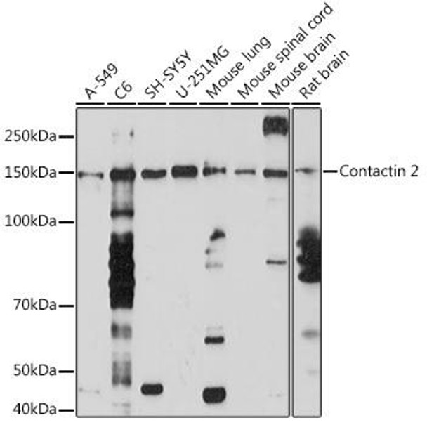Contactin 2 Rabbit Monoclonal Antibody (CAB5137)