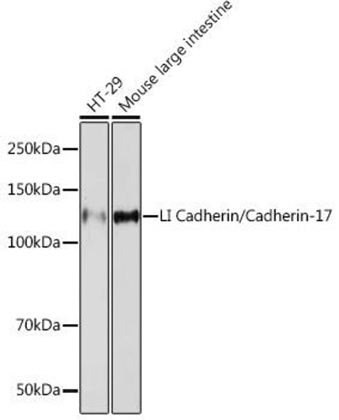 LI Cadherin/Cadherin-17 Rabbit Monoclonal Antibody (CAB5286)