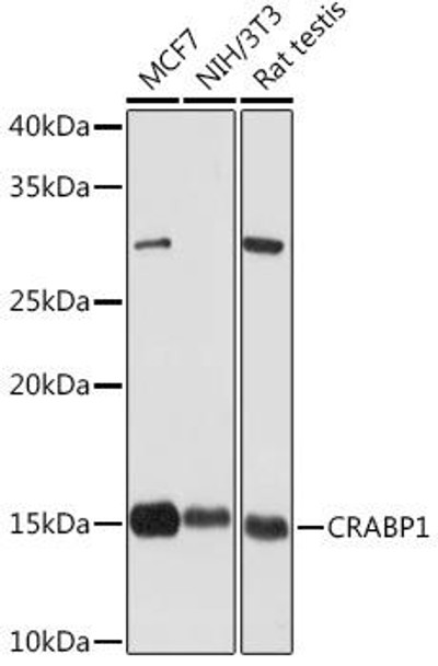 CRABP1 Rabbit Monoclonal Antibody (CAB5434)