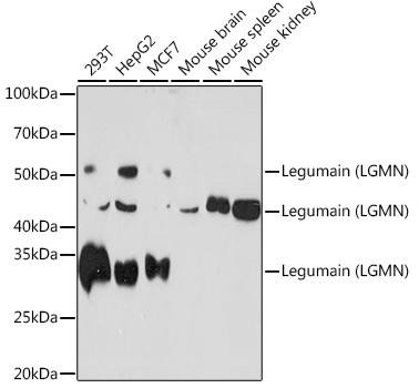 Legumain (LGMN) Rabbit Monoclonal Antibody (CAB6829)