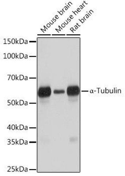 α-Tubulin Rabbit Monoclonal Antibody (CAB6830)
