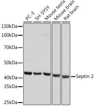Septin 2 Rabbit Monoclonal Antibody (CAB7163)