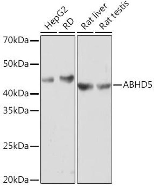 ABHD5 Rabbit Monoclonal Antibody (CAB8673)