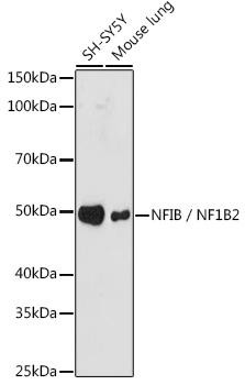 NFIB/NF1B2 Rabbit Monoclonal Antibody (CAB9125)