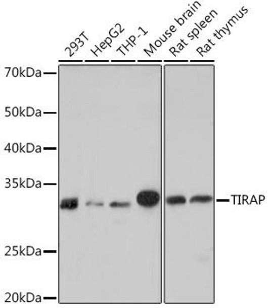 TIRAP Rabbit Monoclonal Antibody (CAB9663)