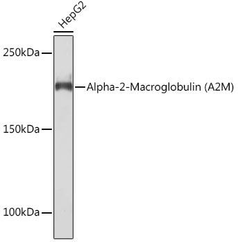 Alpha-2-Macroglobulin (A2M) Rabbit Monoclonal Antibody (CAB9752)
