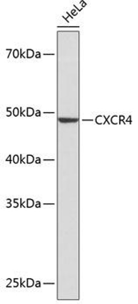 Anti-CXCR4 Antibody (CAB19035)