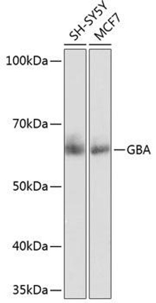Anti-GBA Antibody (CAB19057)
