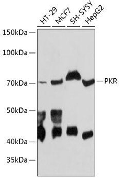 Anti-PKR Antibody (CAB19545)