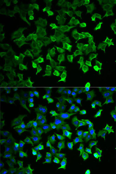 Anti-HSP70 Antibody (CAB0284)