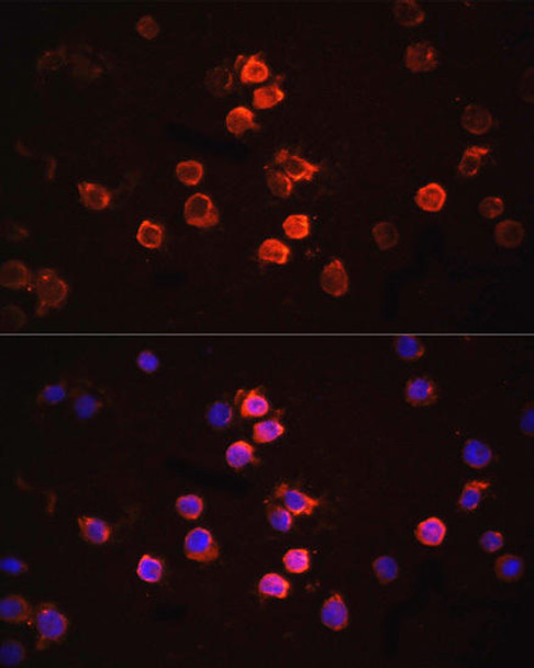 Anti-IL-1 beta Antibody (CAB11370)