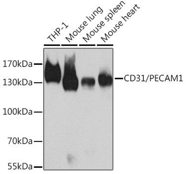 Anti-CD31/PECAM1 Antibody (CAB11525)