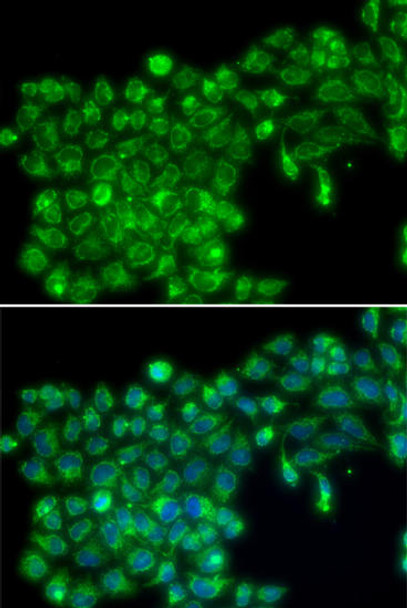 Anti-TNFSF13 Antibody (CAB13570)