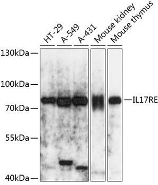 Anti-IL-17RE Antibody (CAB14315)