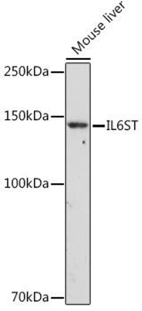 Anti-IL-6ST Antibody (CAB14656)