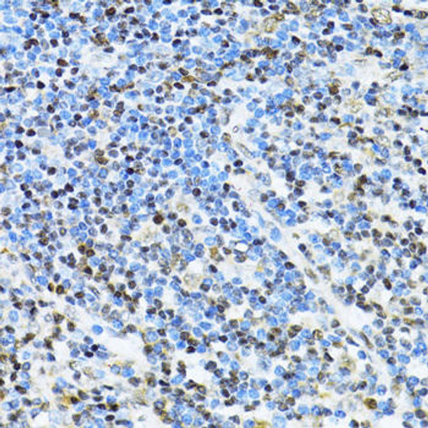 Anti-ITGB3BP Antibody (CAB14859)