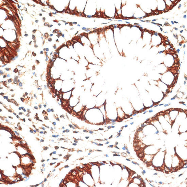 Anti-KRT13 Antibody (CAB16393)