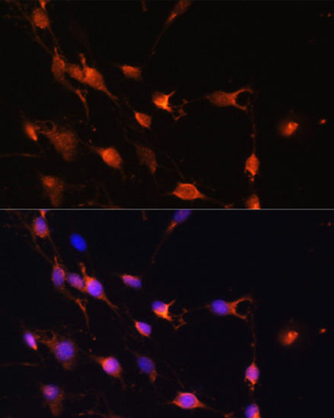 Anti-RAB11A Antibody (CAB17031)