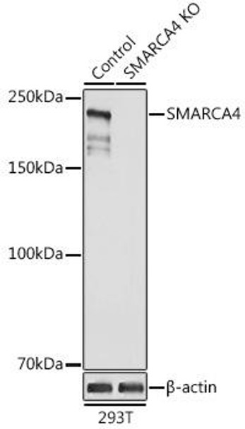 Anti-SMARCA4 Antibody (CAB2117)[KO Validated]