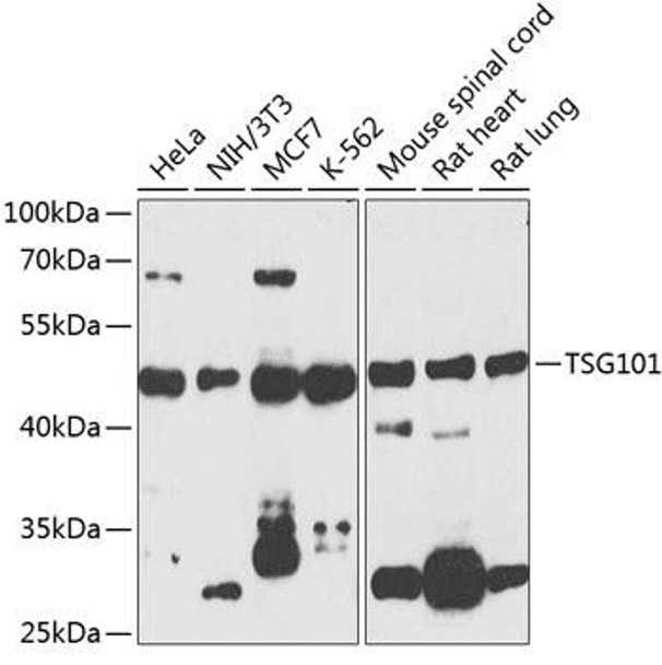 Anti-TSG101 Antibody (CAB2216)