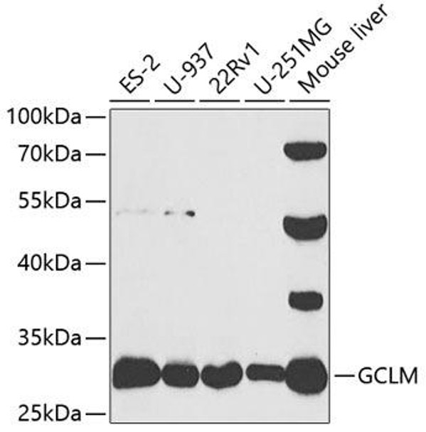 Anti-GCLM Antibody (CAB5314)