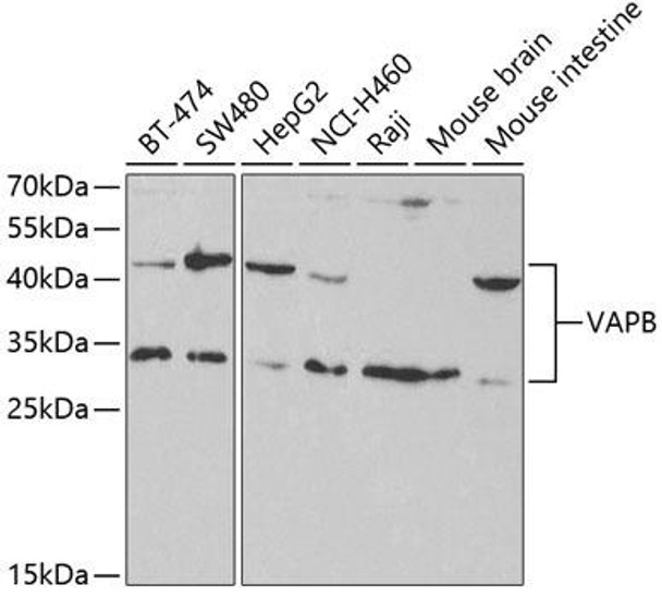 Anti-VAPB Antibody (CAB5363)