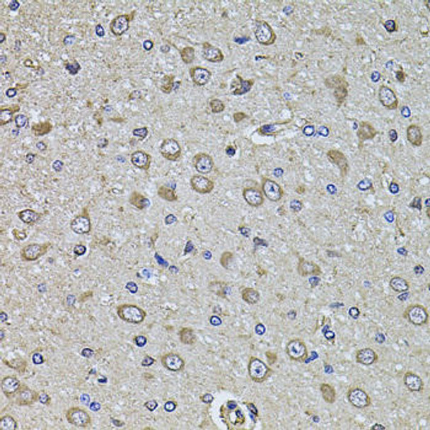 Anti-EPHA3 Antibody (CAB8414)